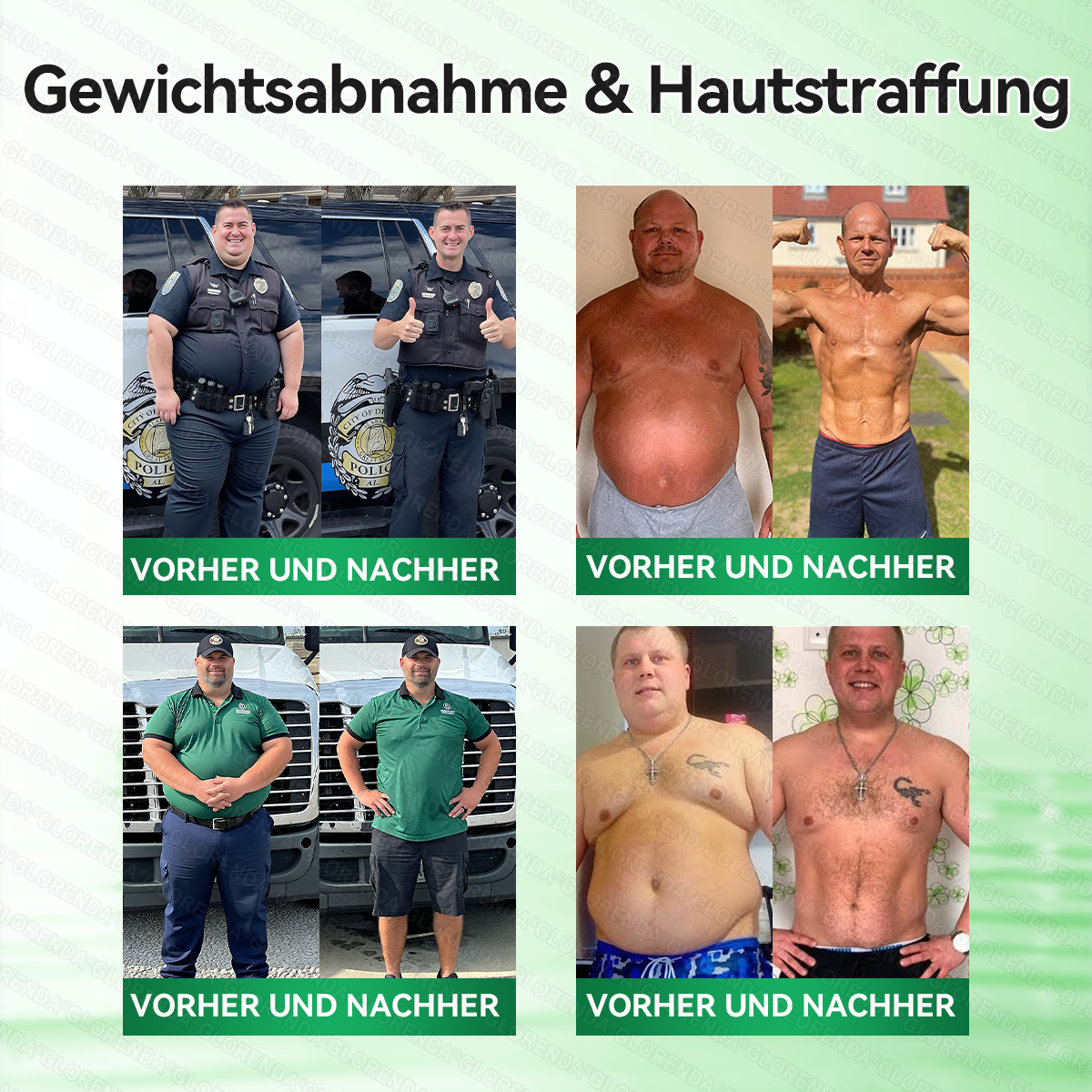 🇩🇪𝐎𝐟𝐟𝐢𝐳𝐢𝐞𝐥𝐥𝐞𝐫 𝐒𝐡𝐨𝐩 |🌸𝑮𝑳𝑶𝐑𝐄𝐍𝐃𝘼®10-𝙞𝙣-𝟏 𝐀𝐝𝐯𝐚𝗻𝗰𝗲𝗱 𝗡𝗮𝙣𝙤 𝙈𝙞𝙠𝙧𝐨𝐧𝐚𝐝𝐞𝐥-𝐏𝐚𝒕𝒄𝗵